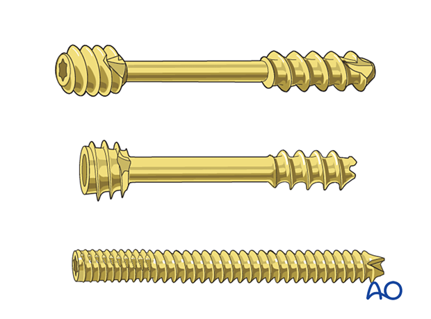 Types of headless compression screws