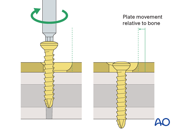 Principle of dynamic compression