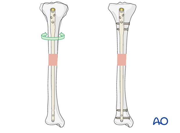 Rotational stability