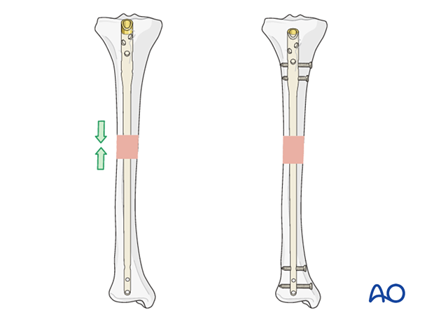 Longitudinal stability