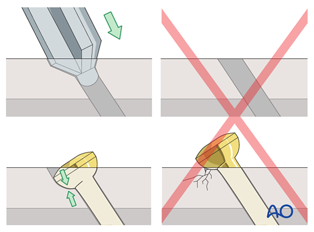 Countersinking