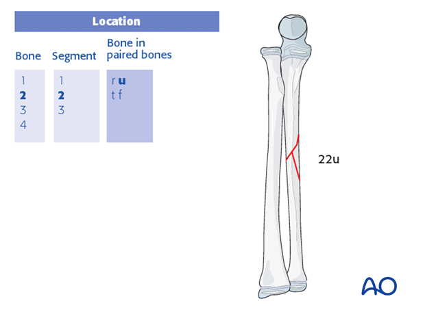 classification of childrens fractures