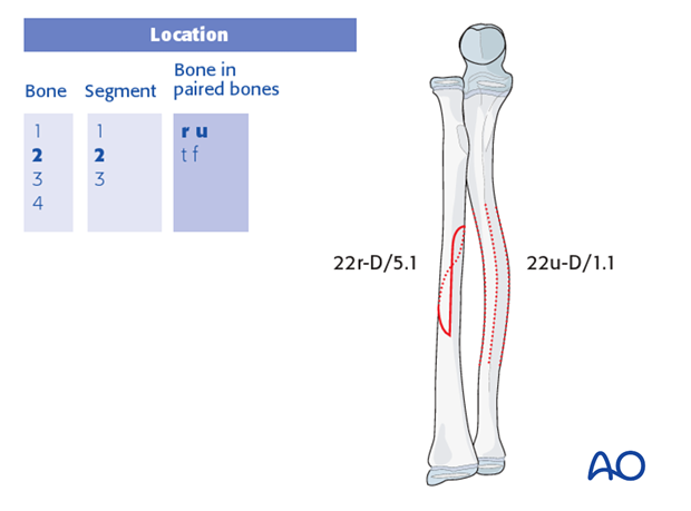 classification of childrens fractures