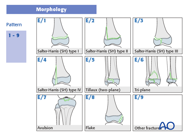 classification of childrens fractures