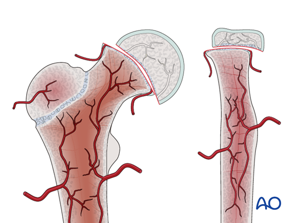 the physis