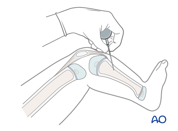 pediatric polytrauma