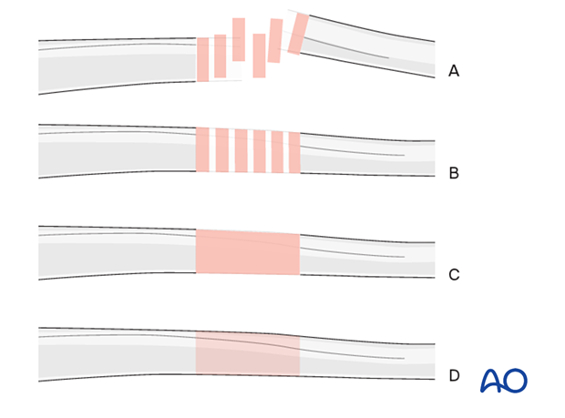 Generic fracture patterns