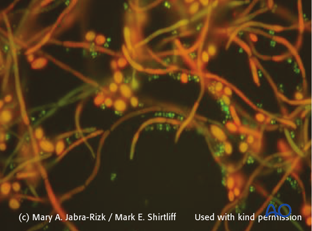 Mixed micro-organism biofilm