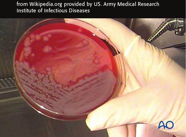 Infecting microorganisms should be identified, their antibiotic sensitivities defined, and appropriate specific antibiotics admi