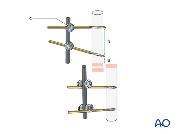 basic technique modular external fixation