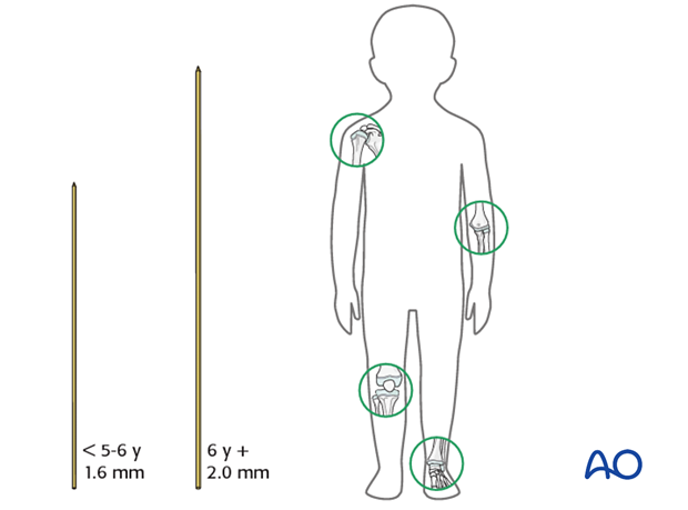 K-wire size