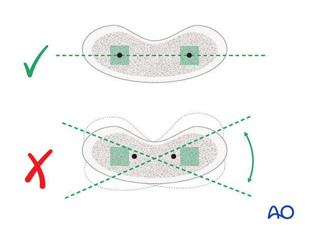 Rotational stability