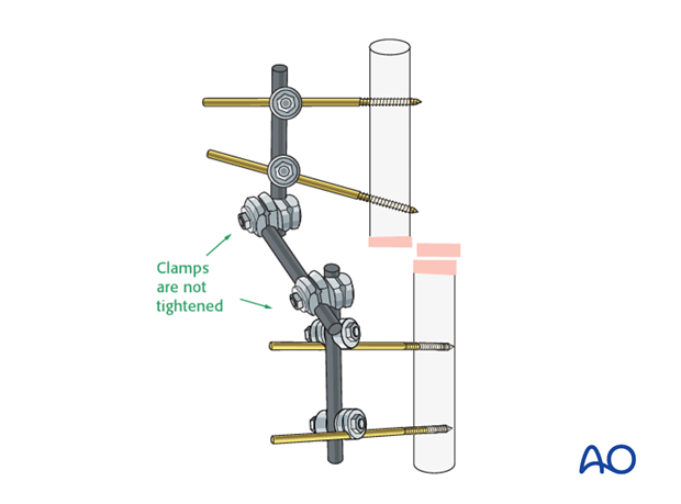 Frame assembly