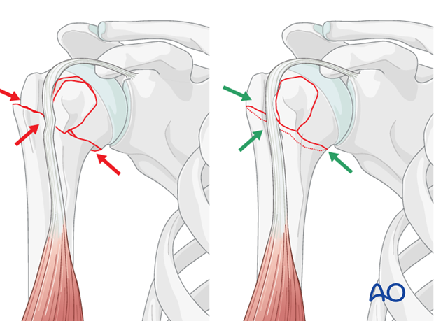 Confirm proper rotational alignment