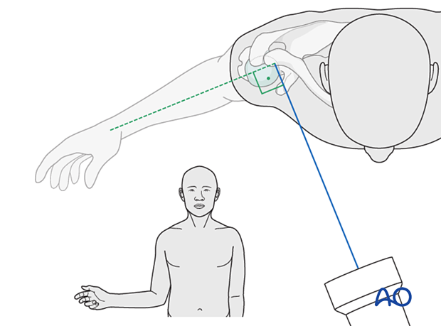 Positioning for optimal lateral view of the proximal humerus