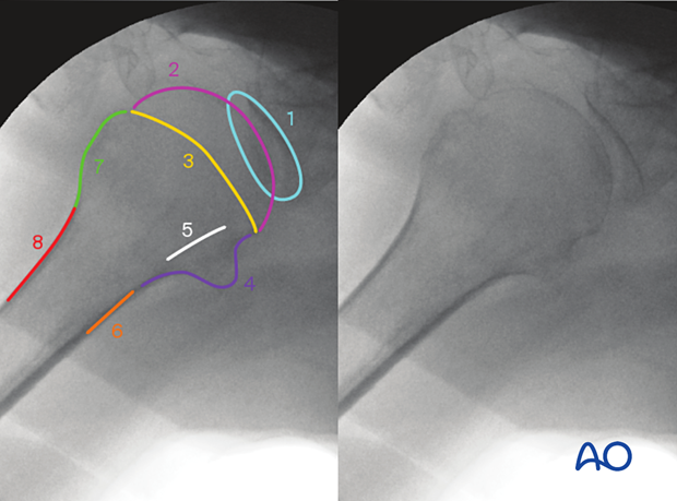 Anatomical lines and landmarks in the lateral view