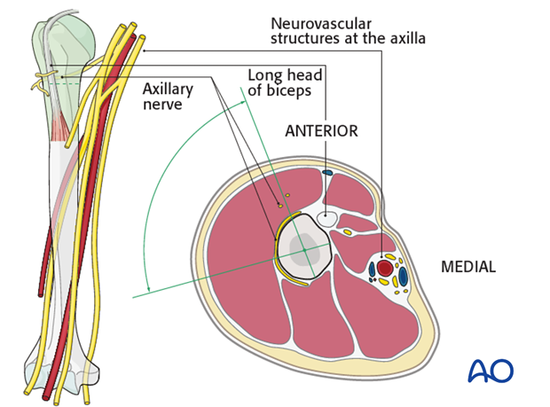 Safe zones for percutaneous pins or screws