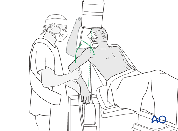 Final check of osteosynthesis