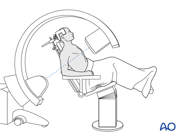 C-arm positioning