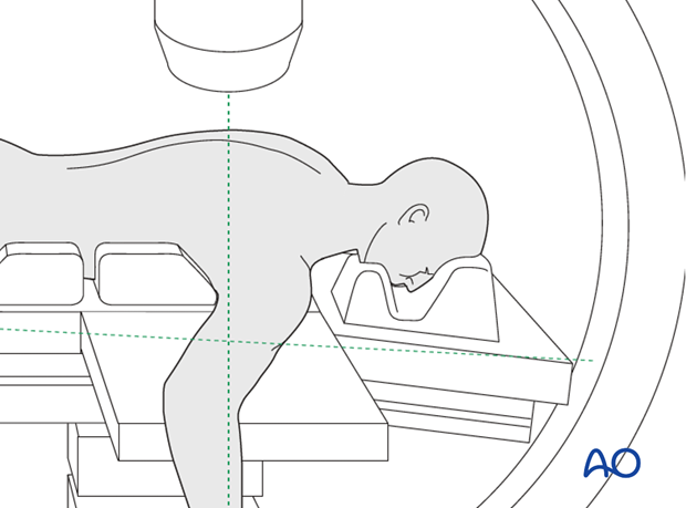 C-arm positioning