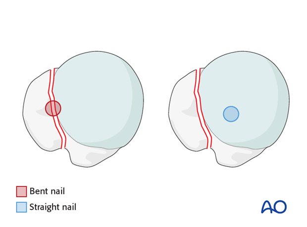 bent vs straight nails