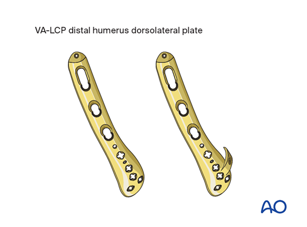 VA-LCP distal humerus dorsolateral plate