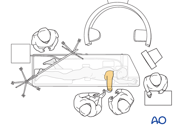 Operating room set-up with patient in lateral decubitus position