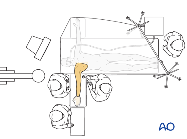 Operating room set-up with patient supine