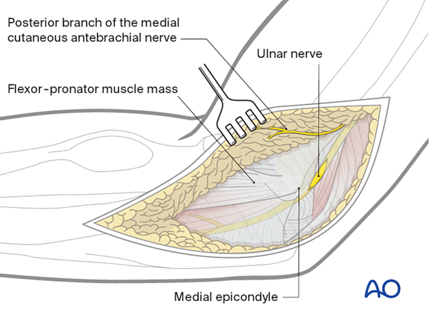 Ulnar nerve anatomy