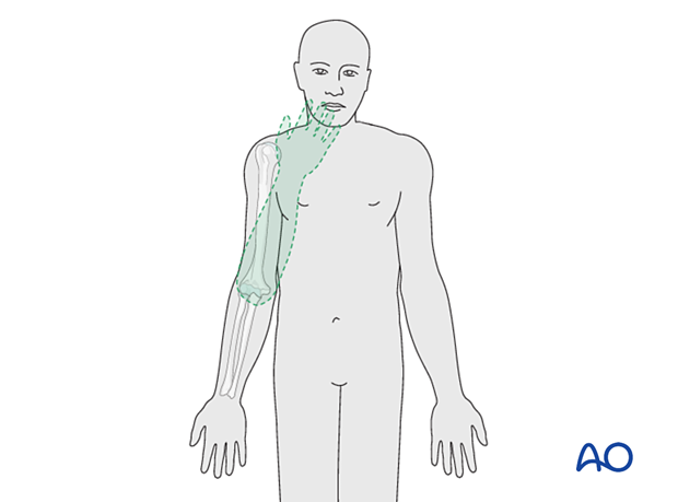 During elbow flexion, the forearm moves on a plane such that the hand goes directly towards the mouth.