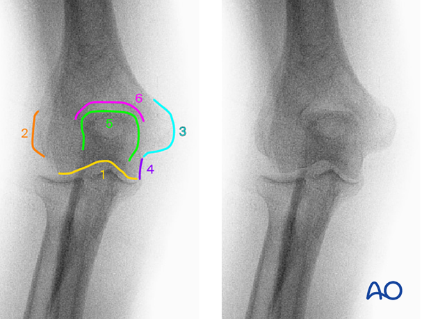 Intraoperative imaging