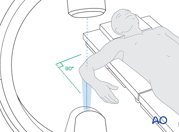 Positioning for optimal lateral view of distal humerus