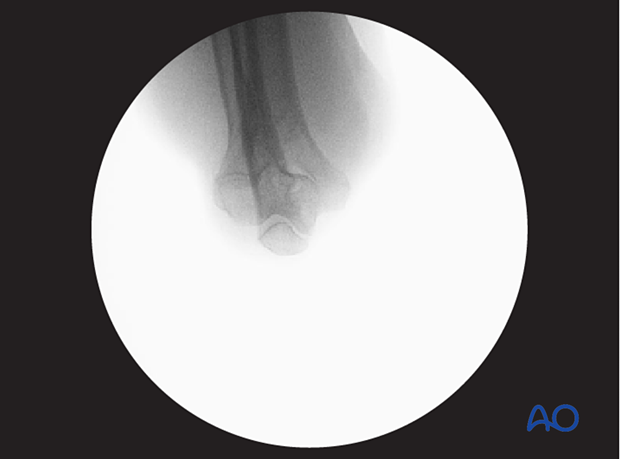 Verification of optimal axial view