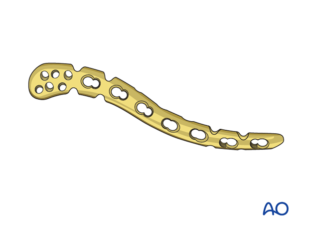 orif pre contoured distal plate