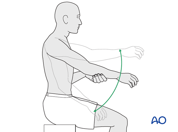 Actively assisted elevation above shoulder level can be introduced.