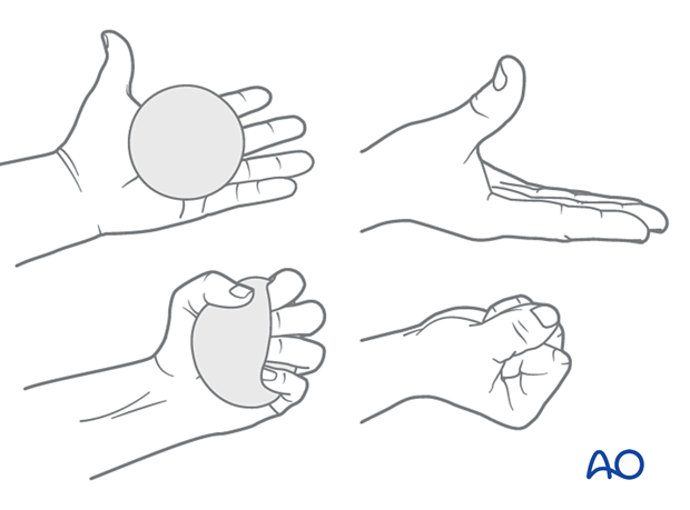 Squeezing of a soft ball