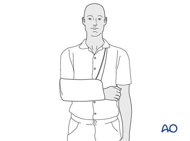 approach to the le fort i level of the midface in cleft lip and palate patients