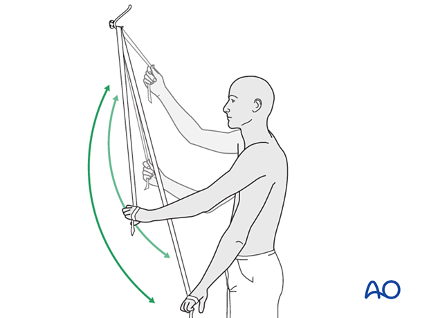 With the pulley placed above the patient, the unaffected left arm can be used to provide full passive forward flexion of the injured right shoulder.