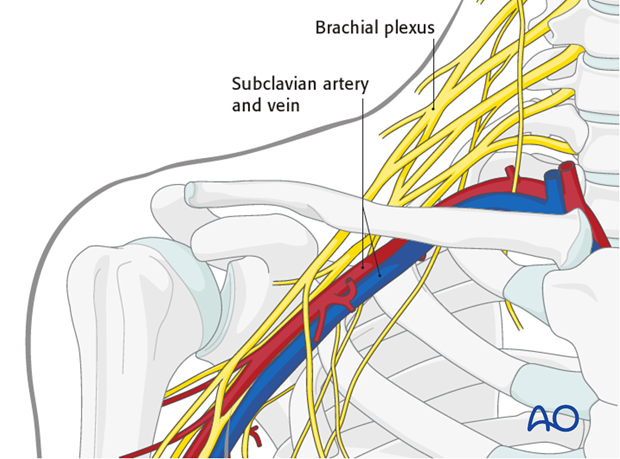 flexible intramedullary nail