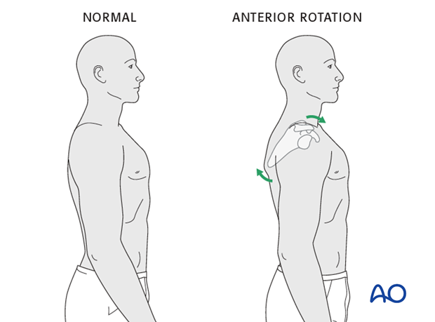 clinical and radiological examination of patients with clavicle injuries