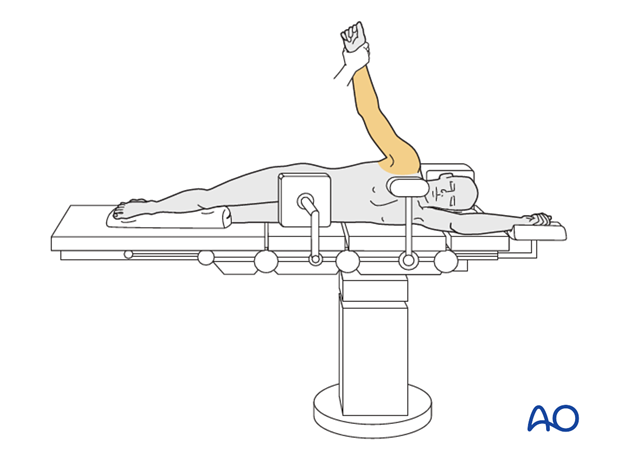 lateral decubitus position