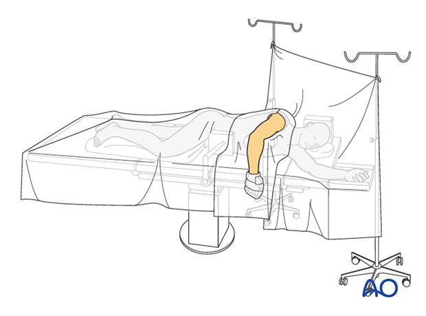 lateral decubitus position