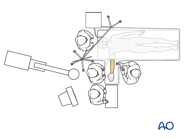 supine for anterior access