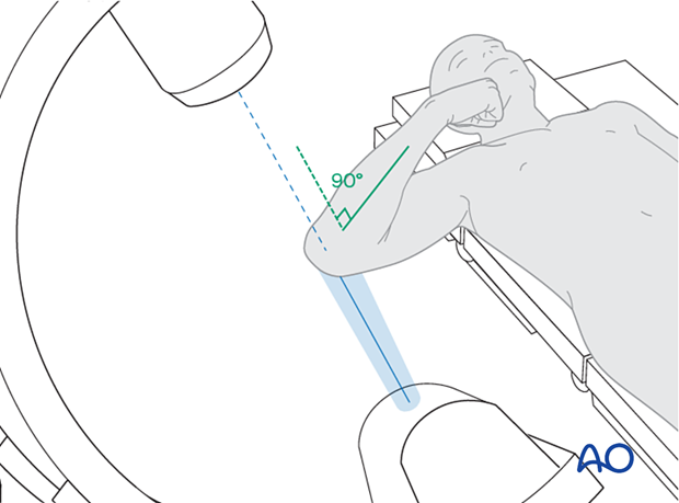 Positioning for optimal axial view