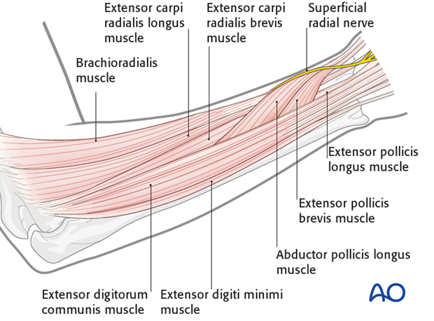 Safe zones for pin placement in the forearm