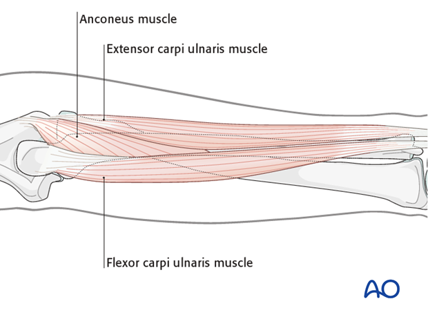 Safe zones for pin placement in the forearm