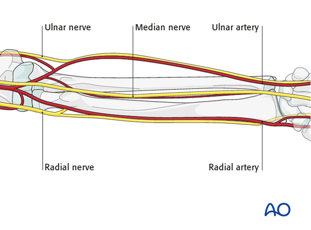 safe zones for pin placement in the forearm