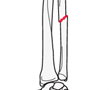 forearm shaft