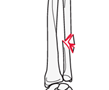 forearm shaft