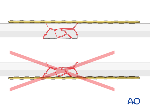 Optimal plate position